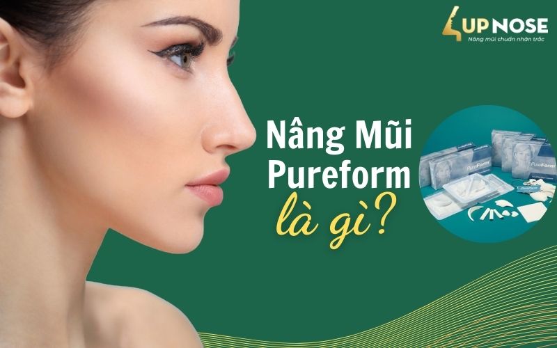 nâng mũi cấu trúc pureform là gì