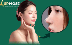 nâng mũi cấu trúc giá bao nhiêu